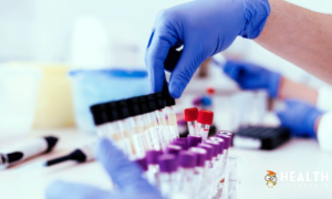 Catching Health Issues Early